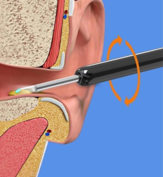 🔥Wireless WIFI Visual Ear Pick