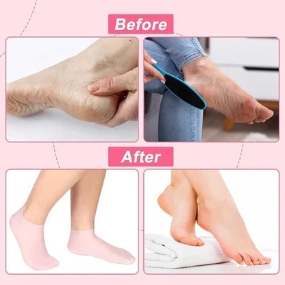 2024 New Hote Sale🔥🔥-Foot Spa Moisturizing Exfoliating Silicone Socks